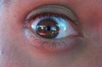 Mi ojoMy eye